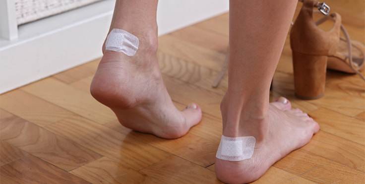 How should blisters be treated